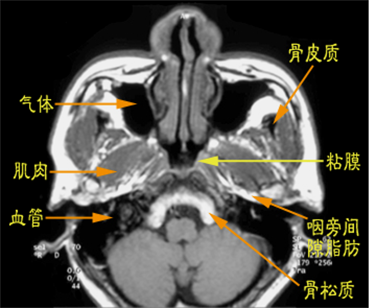 塌鼻梁有救了！超詳細『立體鼻影畫法』，全臉修容原來這麼簡單！｜PopDaily 波波黛莉