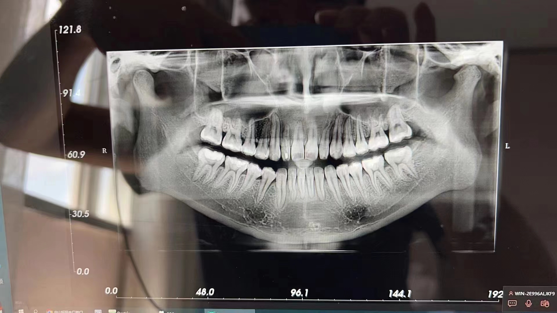 美亚CBCT1.jpg